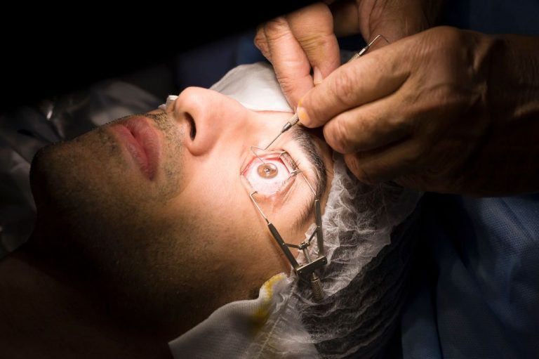 Lasik eye surgery